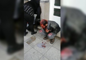 Recibe brutal golpiza y muere